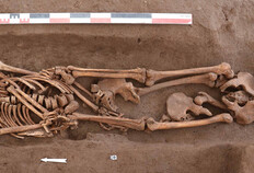 Vue d'une tombe avec des restes de corps provenant des dissections de l'Ecole de médecine de Tours (seconde moitié du XVIIIe s.). On distingue l'inhumation d'un individu sur le dos, mais pour lequel il manque le membre inférieur droit et dont une partie du bassin est aussi absente. Ces éléments (illium avec son fémur et la moitié du sacrum) ont été redéposés un peu plus loin, le long du fémur gauche. On voit très bien la découpe nette du sacrum. Des fragments d'un ou deux autres individus ont été déposés à l'est sur le membre inférieur gauche du défunt. On distingue deux calottes crâniennes sciées et la partie inférieure d'un corps (bassin complet avec les deux membres inférieurs).